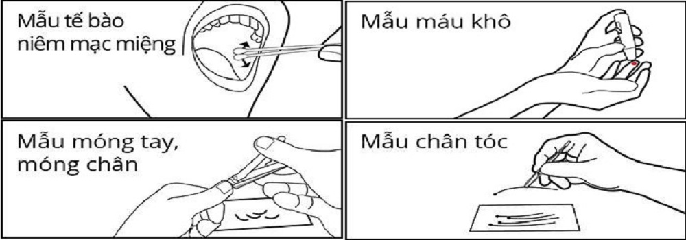 Xét nghiệm ADN cha con giá rẻ, Xét nghiệm ADN cha con giá rẻ